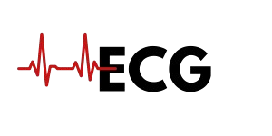 ECG-removebg-preview
